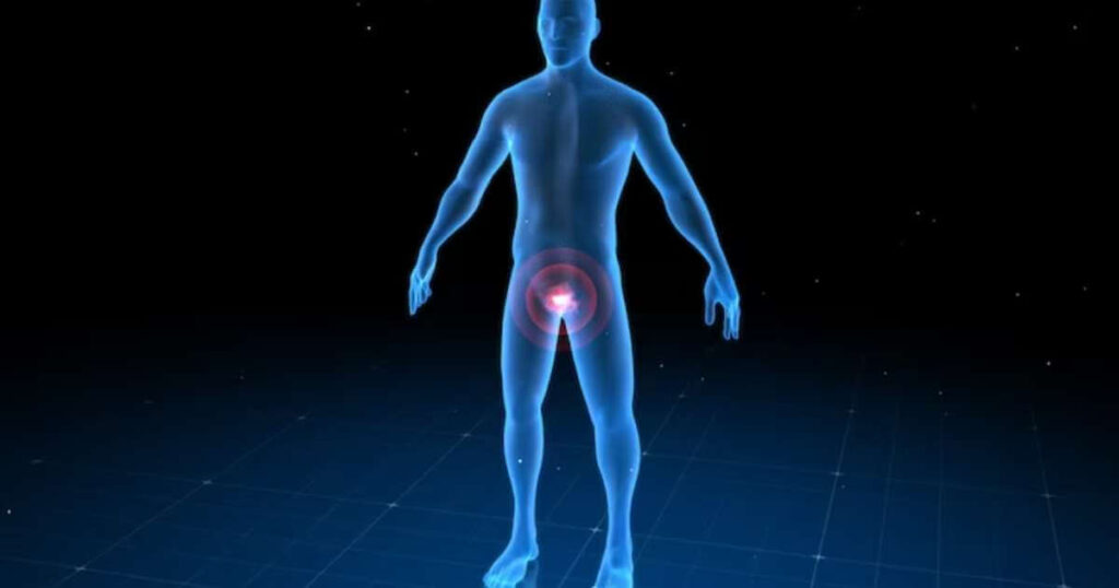 prostatectomia Robótica