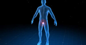 prostatectomia Robótica