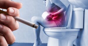 A relação entre cigarro e câncer de bexiga